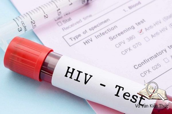 Dấu hiệu HIV ở nam giới sớm nhất